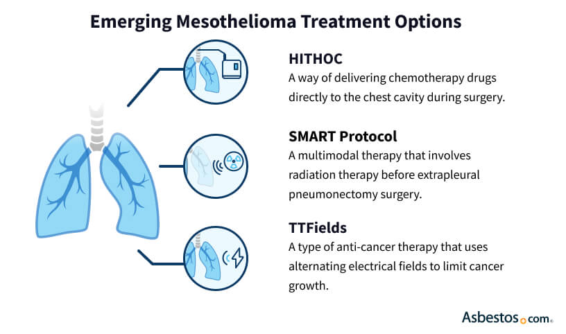 The lastest mesothelioma treatment options
