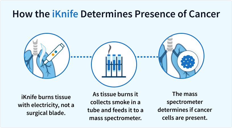 How the iKnife determines the presence of cancer