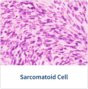 Sarcomatoid cell mesothelioma stain