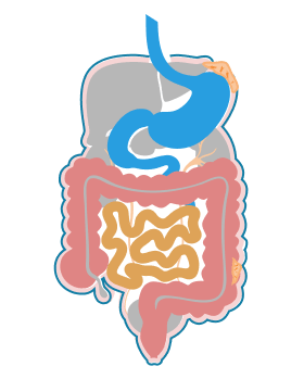 Stage 2 of Peritoneal Mesothelioma