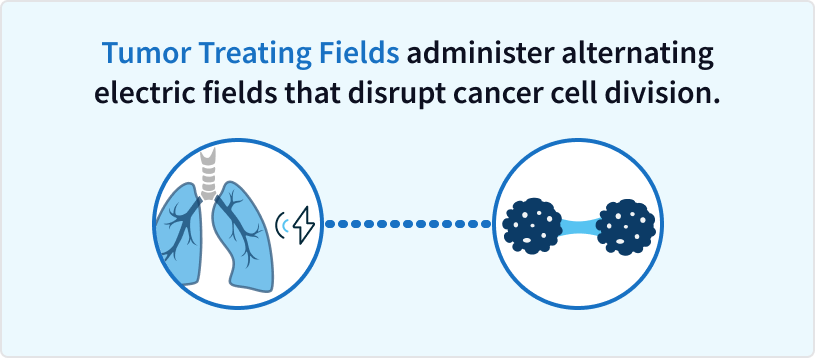 How Tumor Treating Fields works